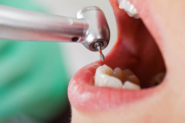 Best Emergency Dental Surgery in Plantsville, CT